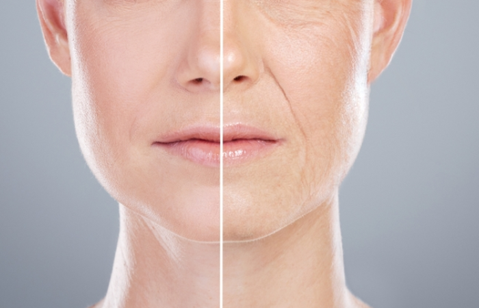 Anti-Aging Treatments